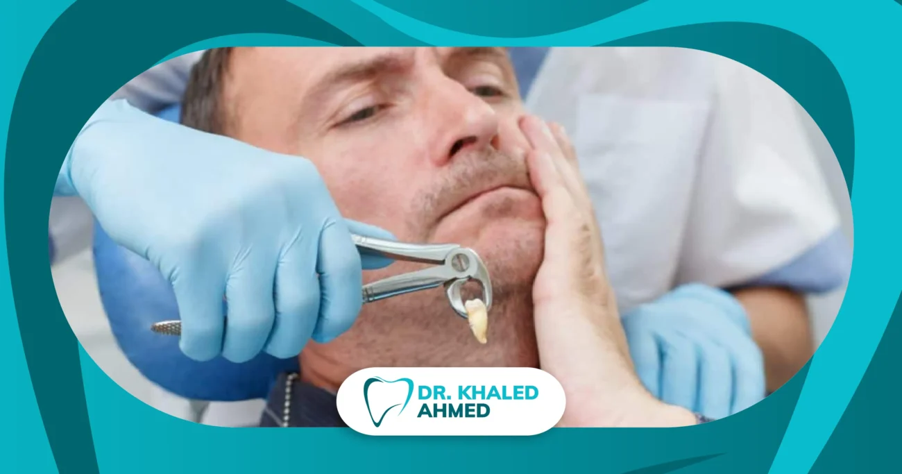 نصائح بعد خلع ضرس العقل للحفاظ على مكان الخلع وتقليل الألم والتورم وتسريع التعافي